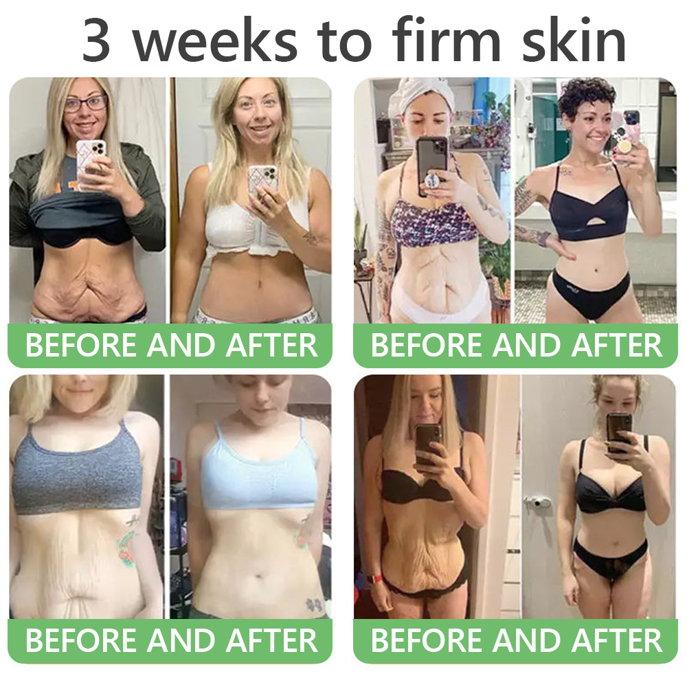 🎁 HISKIN® Only 5 boxes left! We're offering you an additional 30% discount! Get yourself in shape and healthy. Miss out now, and you won't have another chance until next year.