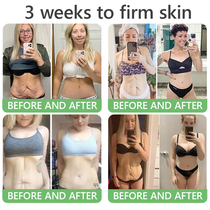 🎁 HISKIN® Only 5 boxes left! We're offering you an additional 30% discount! Get yourself in shape and healthy. Miss out now, and you won't have another chance until next year.