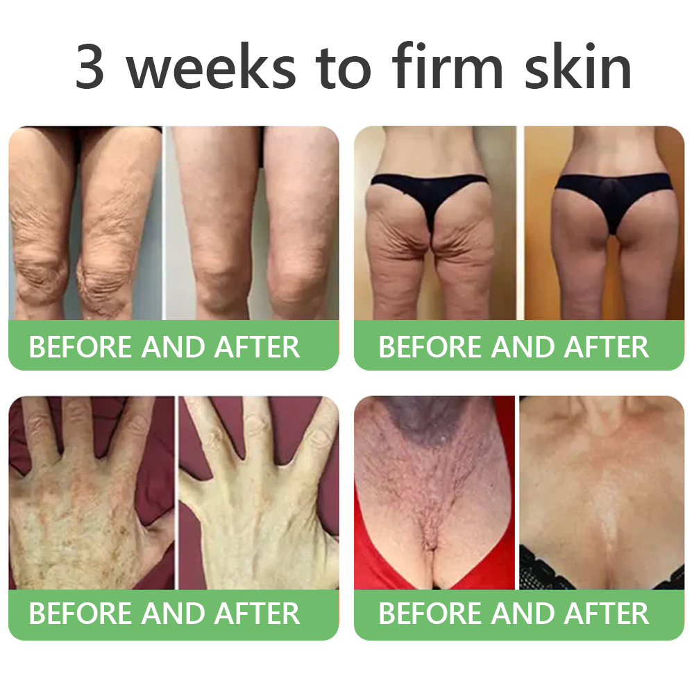🎁 HISKIN® Only 5 boxes left! We're offering you an additional 30% discount! Get yourself in shape and healthy. Miss out now, and you won't have another chance until next year.