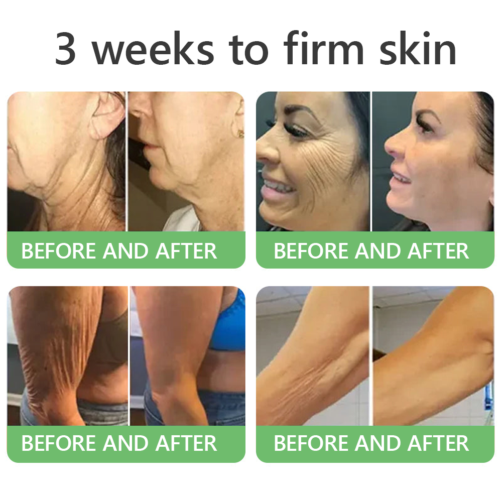 🎁 HISKIN® Only 5 boxes left! We're offering you an additional 30% discount! Get yourself in shape and healthy. Miss out now, and you won't have another chance until next year.